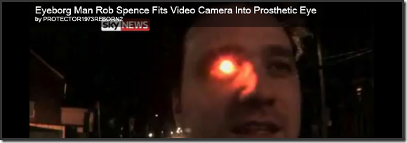 Rob Spence, Eyeborg: Endoscopic, Wireless Web Cam in Prosthetic Eye   40Tech